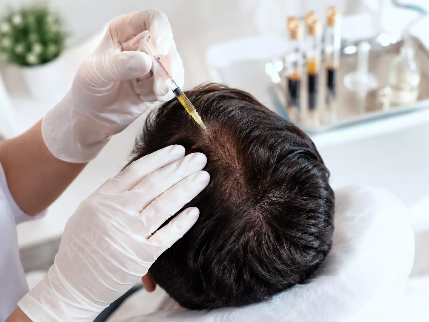 Salud capilar y tratamientos para caída del cabello en Córdoba